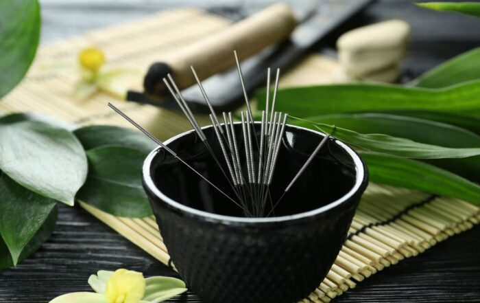 Acupuncture Central Florida