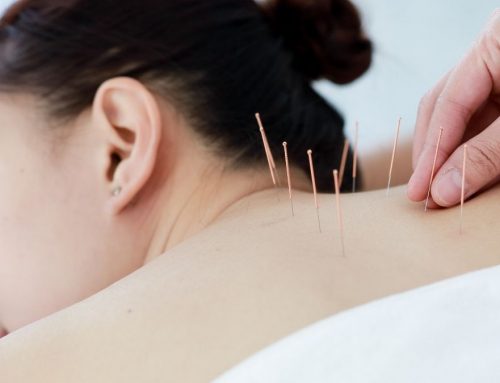 Why Constance Recommends Acupuncture in Winter Park, FL to Clients